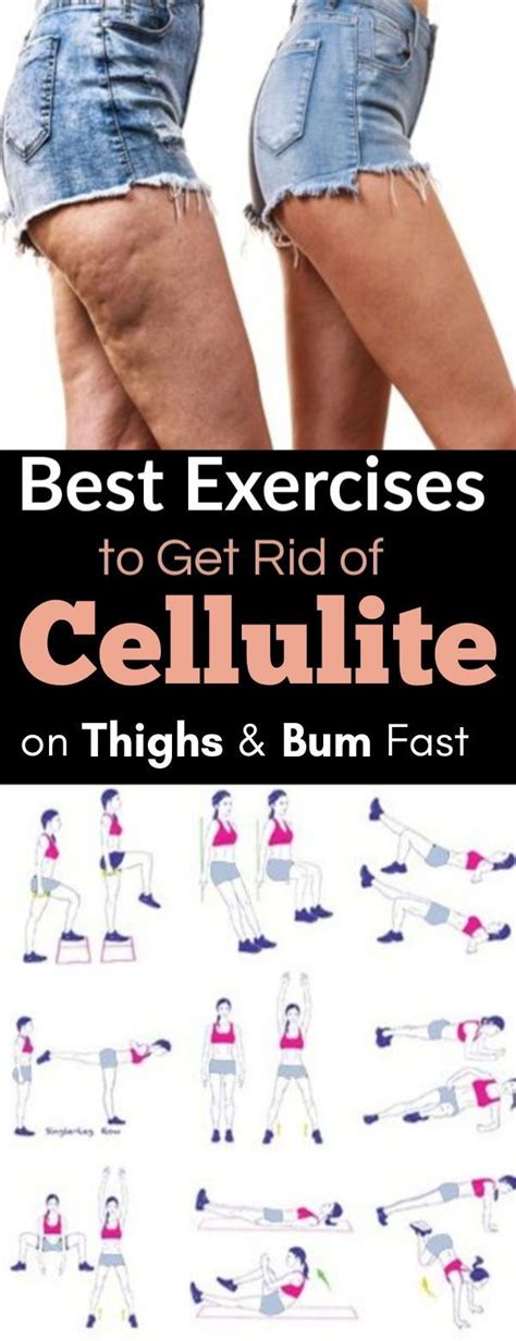 best exercises for cellulite thighs|will walking improve leg cellulite.